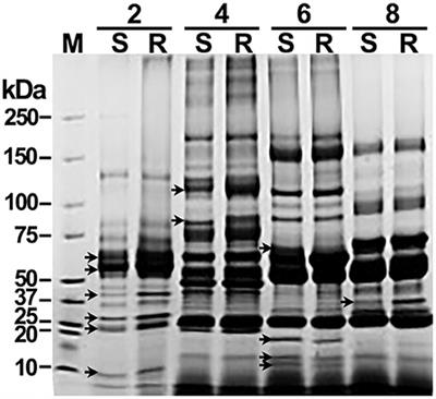 Host Serum Proteins as Potential Biomarkers of Bovine Tuberculosis Resistance Phenotype